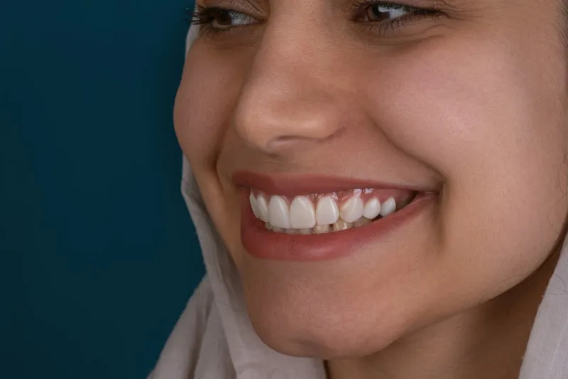 Bright healthy smile after professional teeth whitening at HB Dentist in Huntington Beach