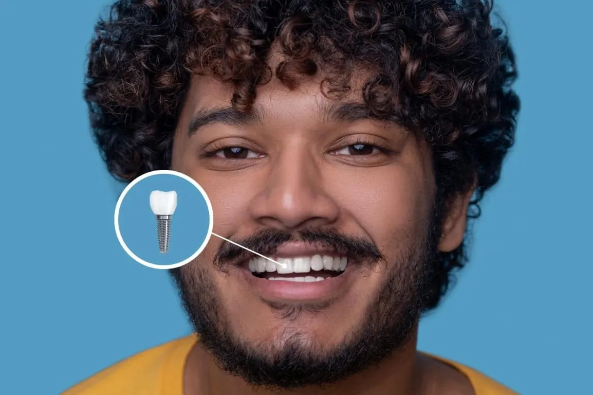 Dental Implants Near Me: How to Choose a Dentist