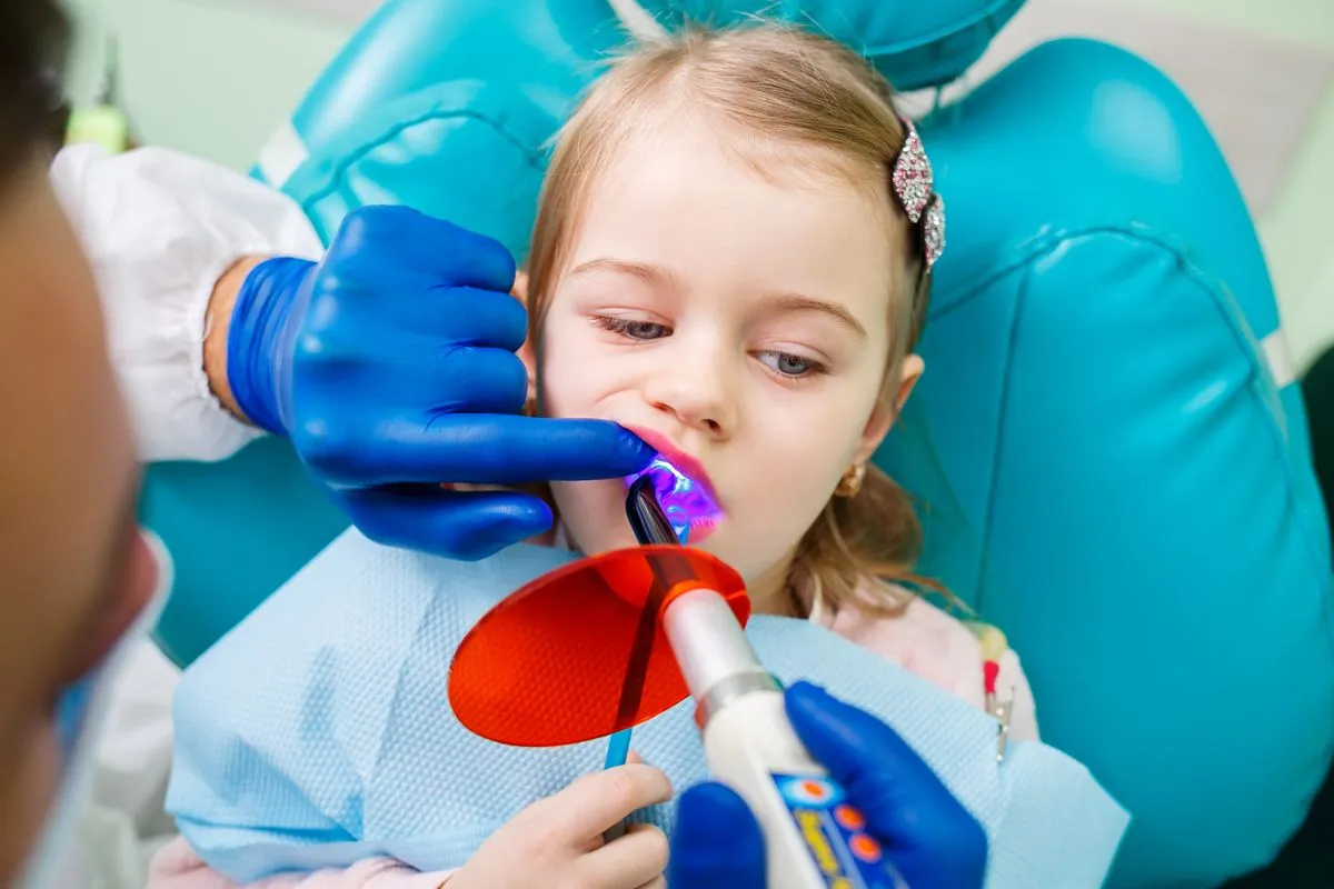 Dental sealants before and after results — Huntington Beach patient, Dr. Richard Baldwin DMD
