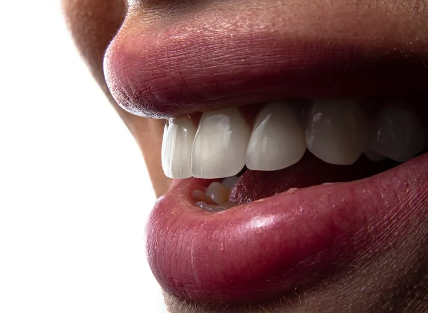 Night Guards for Teeth Grinding: Do You Need One?