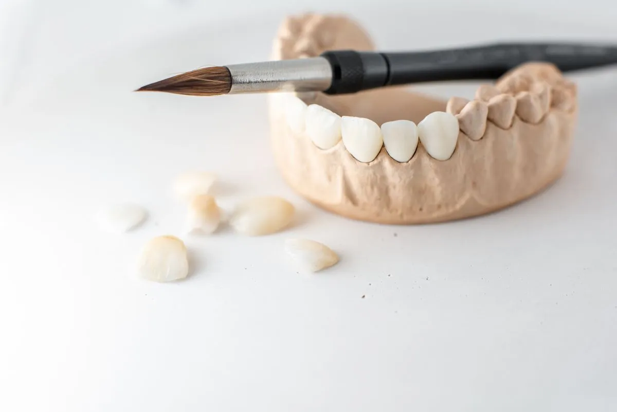Custom color-matched Zirconia dental crown