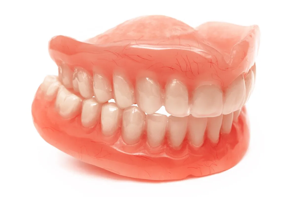 Dental model showing custom-fit removable denture prosthetic design