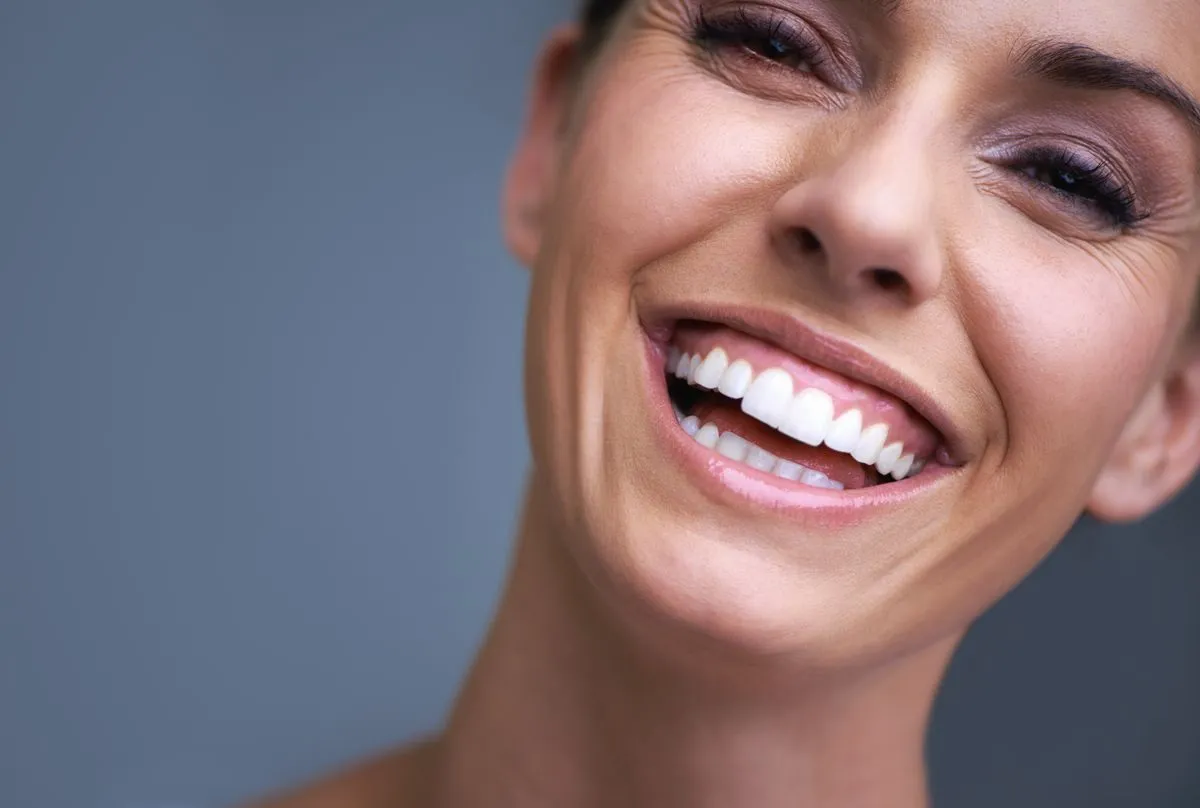 Professional teeth whitening before and after results — Huntington Beach patient, Dr. Richard Baldwin DMD